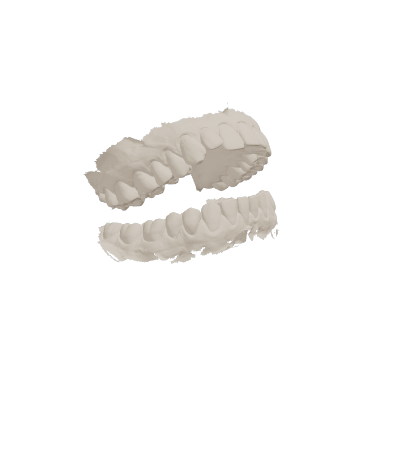 Upper and lower jaw scans